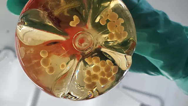 Mão com luva verde segura um frasco de cultura visto por baixo, com dezenas de pequenos aglomerados amarelados de organoides cerebrais em líquido