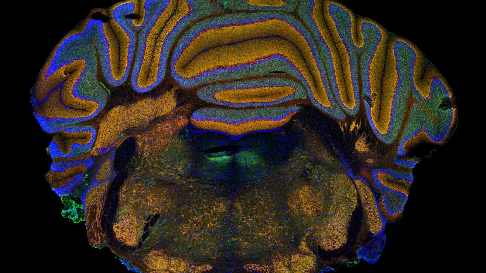 Corte do cérebro de um ratinho visto ao microscópio de fluorescência, com o cerebelo em cima em tons de laranja e azul sobre fundo preto